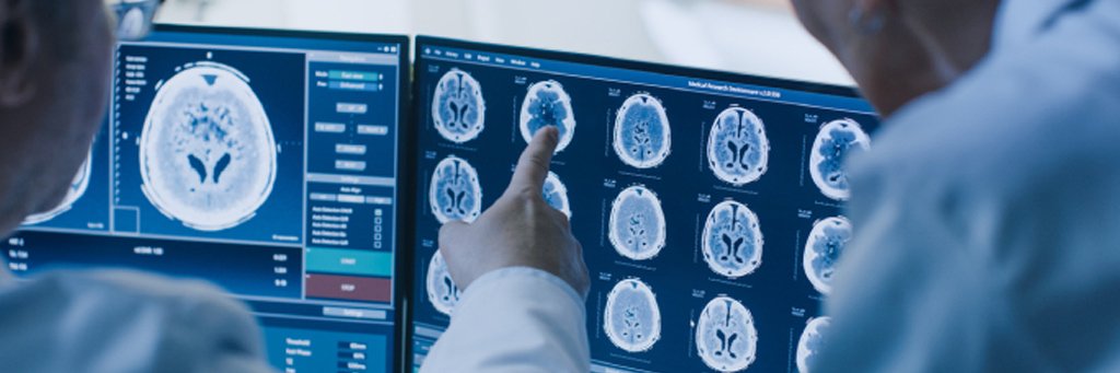 Brain-Injury.jpg